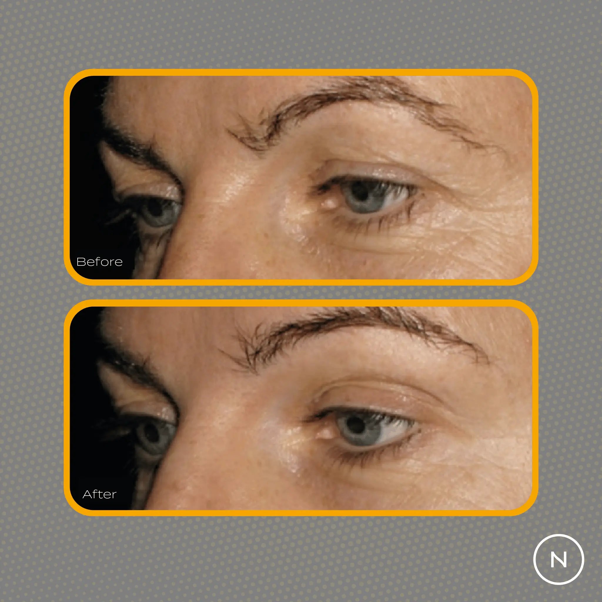 Collagen Peptides Powder